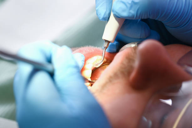 Reliable MS Emergency Dental Service Solutions