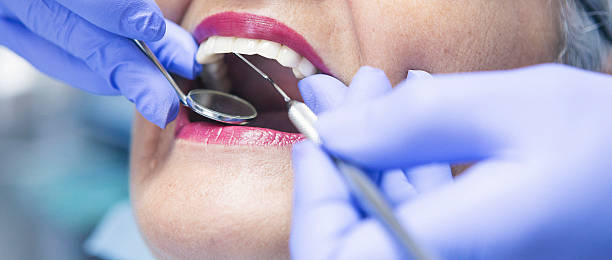 Best Dental Abscess Treatment in Flora, MS